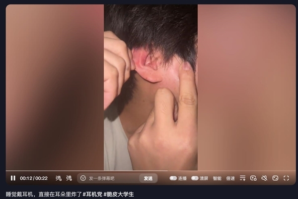 男生戴耳机睡觉 耳机在耳朵里炸了 当事人:不是杂牌70元一副 电商销量已超百万